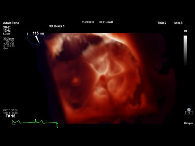 medica 2018 healthcare events 20180926 truevuecardio