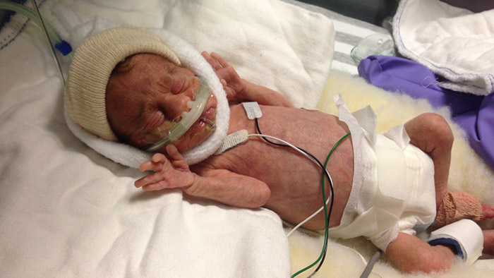 Klinik-Blog:&nbsp;Geschichte Mutter mit Baby auf Neugeborenen-ITS