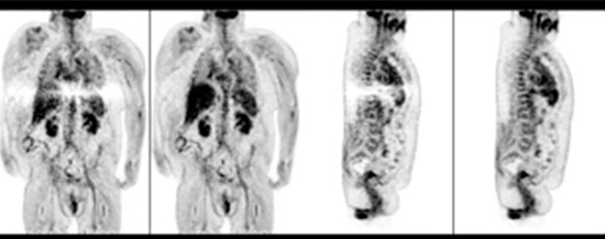 Rekonstruktion Ganzk&ouml;rper-Scan mit Tail-Fitting und mit xClean im Vergleich​