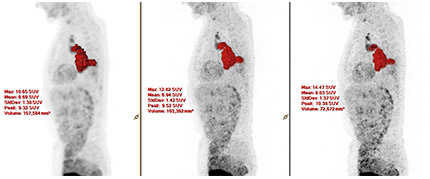 Ganzk&ouml;rper-Scan unter Anwendung von xSharp​