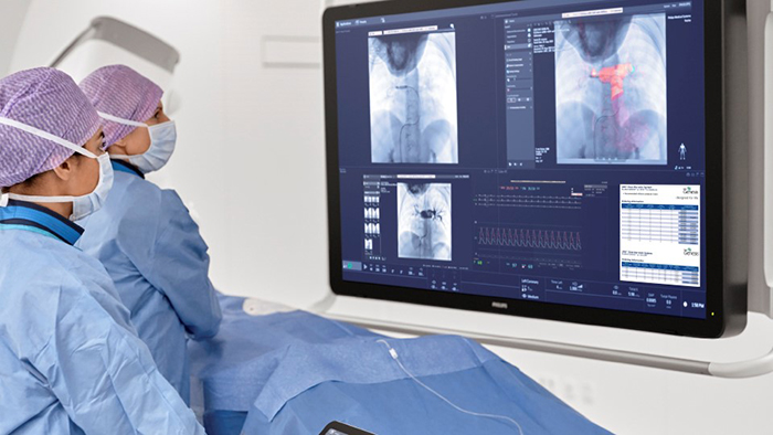 Eingriffe bei Patienten mit angeborenem Herzfehler