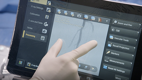 Die neue Generation des Philips Azurion Systems f&uuml;r die interventionelle Radiographie