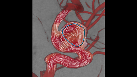 AneurysmFlow