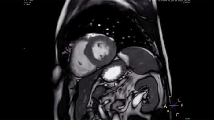 4,8&nbsp;s Atemanhalten