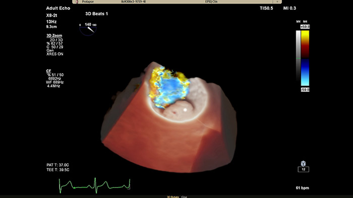 EPIQ CVx – TrueVue Color