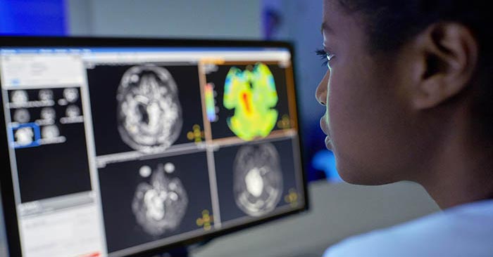 Erh&ouml;hung des Durchsatzes