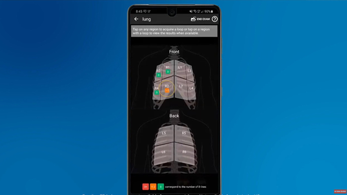 L&ouml;sung mit PW-Doppler-Betrieb