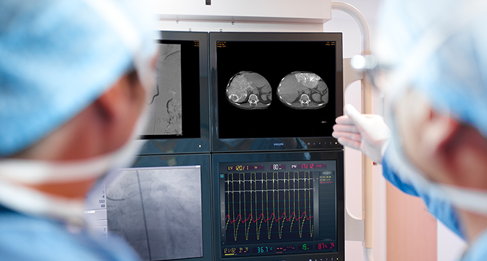 Interventionelle R&ouml;ntgensysteme