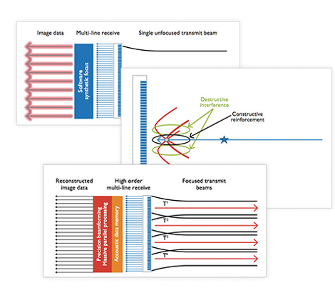 Whitepaper über Philips nSight Imaging