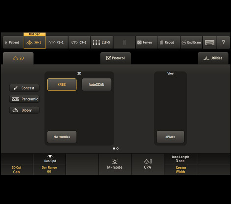 System-Architektur von Philips nSight Imaging