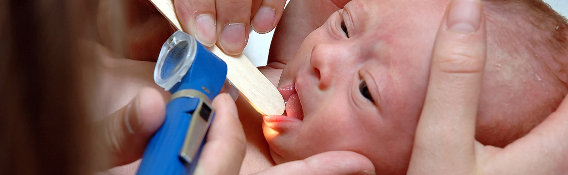 Informationen zur Zungenkinetik von S&auml;uglingen