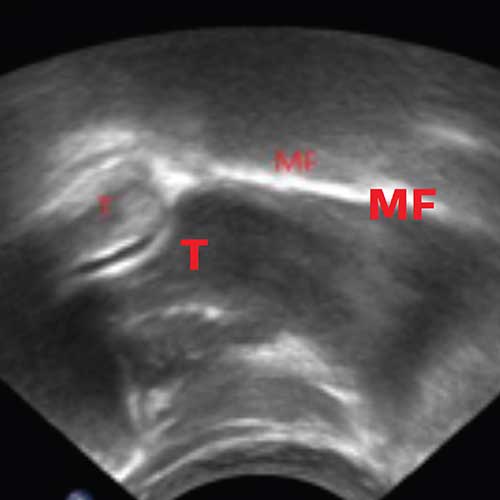 Biomechanik der S&auml;uglingsern&auml;hrung, wissenschaftlich fundiert f&uuml;r Hebammen, HCP