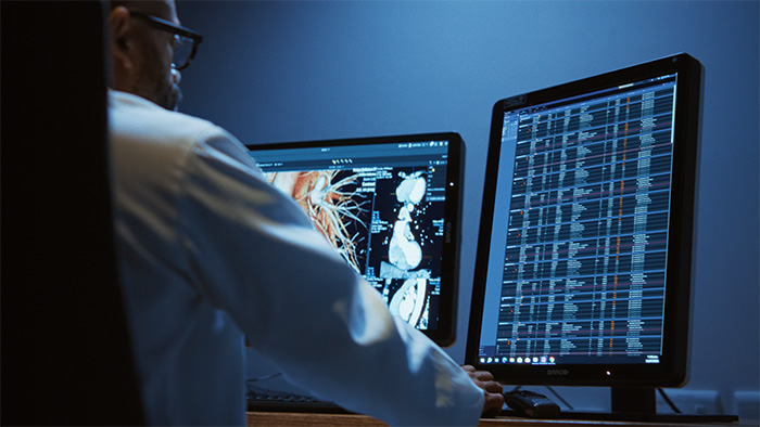 Philips showcases advanced visualization at RSNA 2025