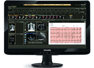 Mit Philips CVIS Informatics &uuml;berwachtes EKG eines Patienten