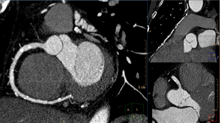 CT&nbsp;Cardiac Viewer