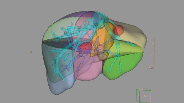 CT&nbsp;Liver Analysis